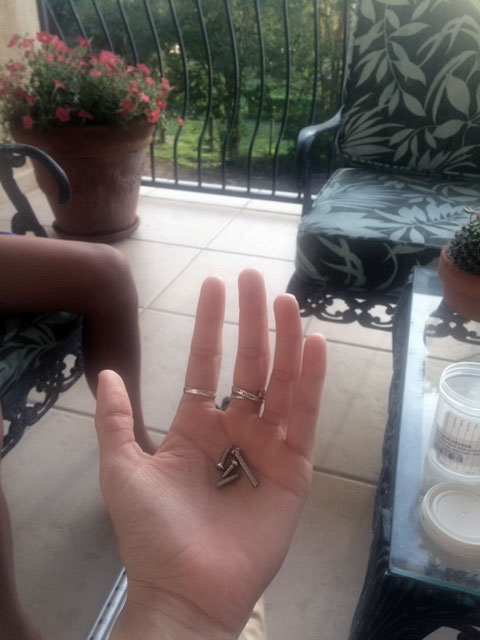 Screws from Havana Solaun's leg surgery. (Havana Solaun)